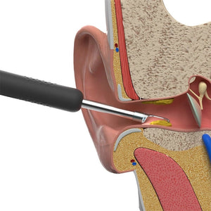 EarCleaner Pro™